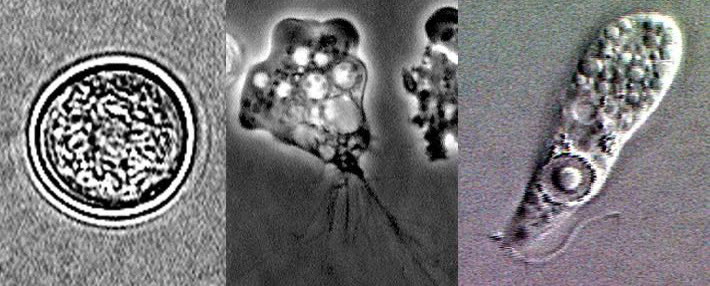 The three forms of Naegleria fowleri seen under the microscope.