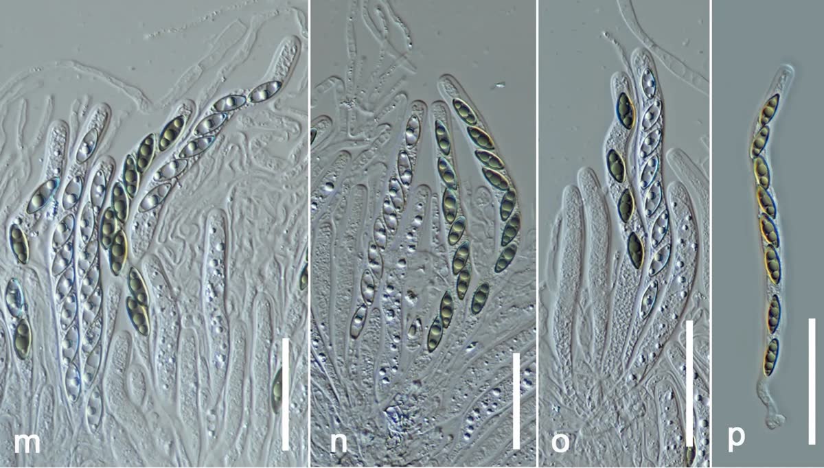 Células reproductoras del hongo vistas al microscopio, tal como aparecen en el estudio científico.
