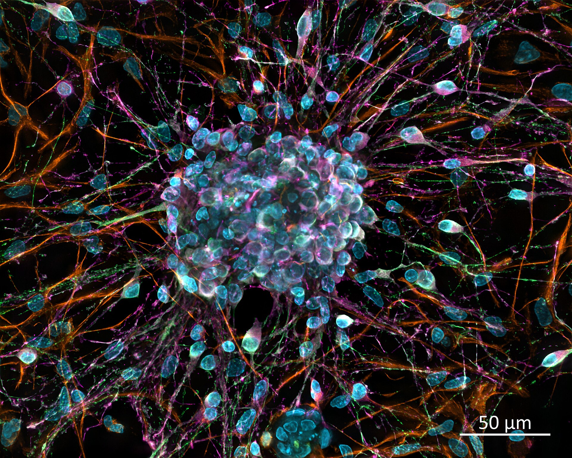 Microscope image of colorfully stained rat neurons: blue nuclei and orange, pink and green extensions on a black background